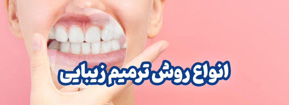 انواع روش ترمیم زیبایی دندان