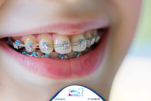 سن ارتودنسی دندان چند است؟