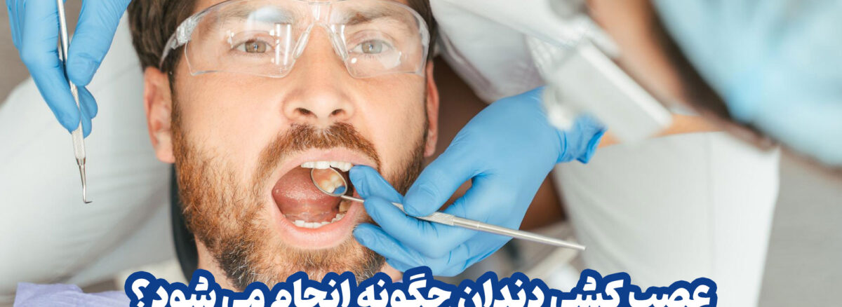 عصب کشی دندان چگونه انجام می شود؟