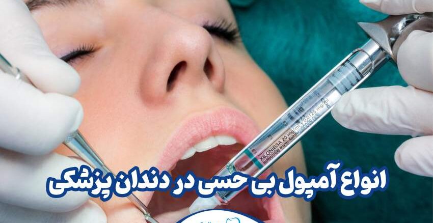 انواع آمپول بی حسی در دندانپزشکی